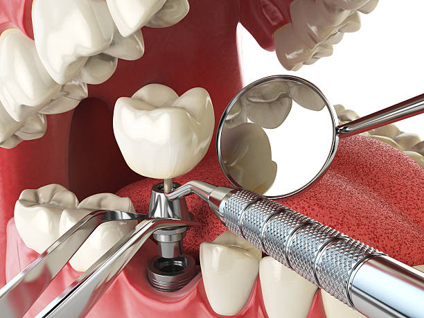 Best Emergency Dental Extractions in Claremont, NC